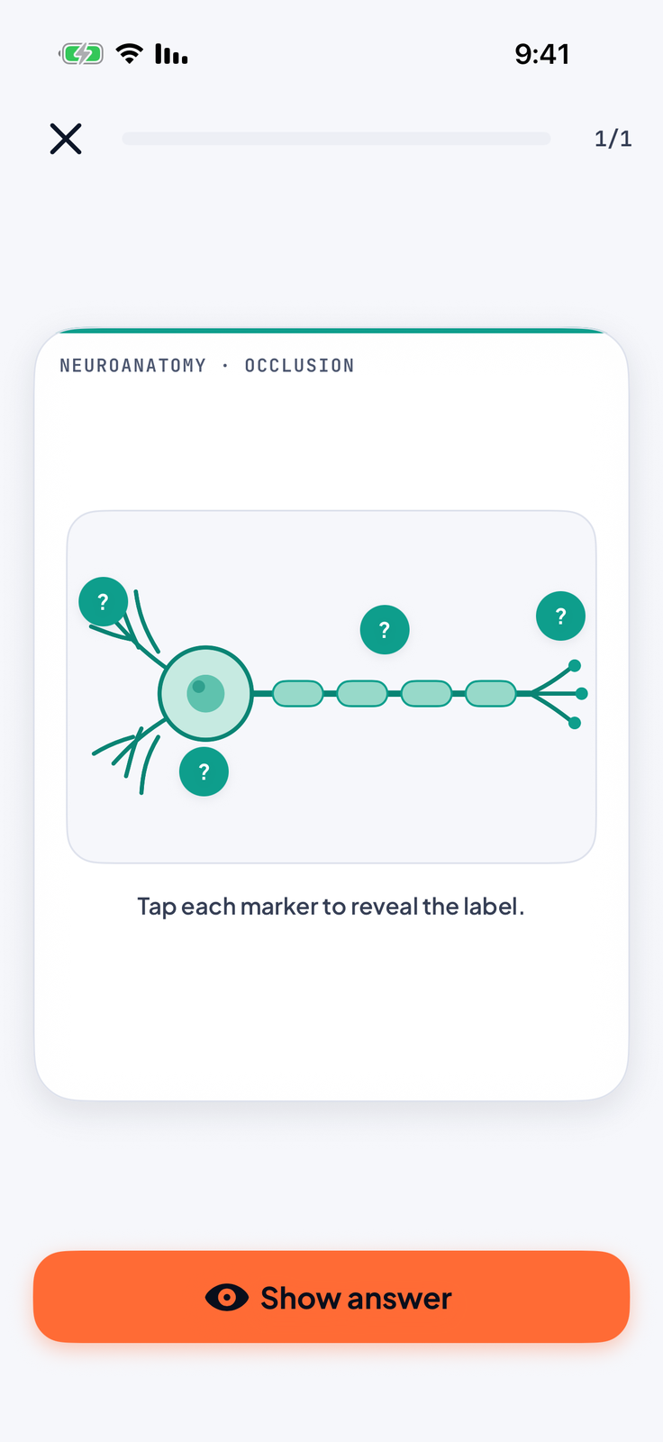 Image occlusion flashcard with hidden labels